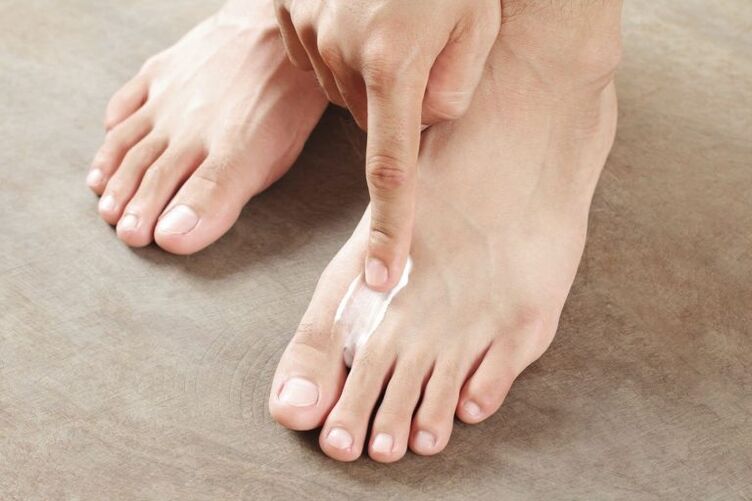 Aplicación de crema antifúngica á pel do pé