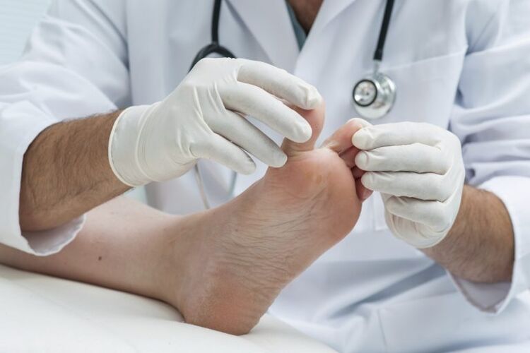 O exame do médico pola presenza de micois