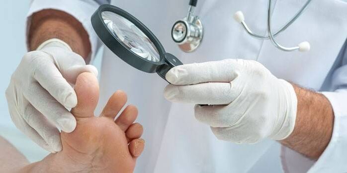 O médico examina os pés en busca de fungos entre os dedos